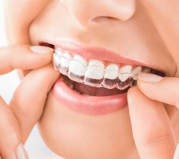 Independence Does Invisalign Really Work