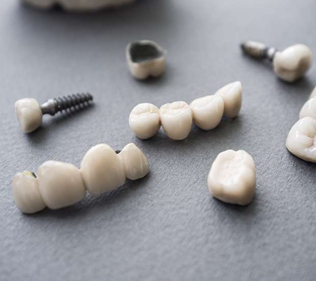 Independence The Difference Between Dental Implants and Mini Dental Implants